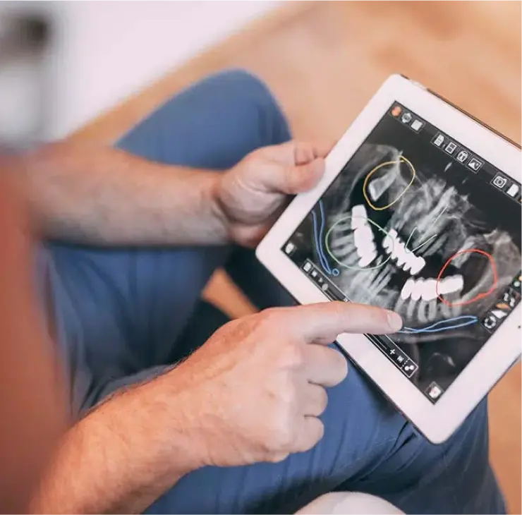 Digitale Röntgenanalyse bei einer endodontischen Behandlung in der Zahnarztpraxis Sandhofpassage Frankfurt – präzise Diagnostik für Wurzelkanalbehandlung