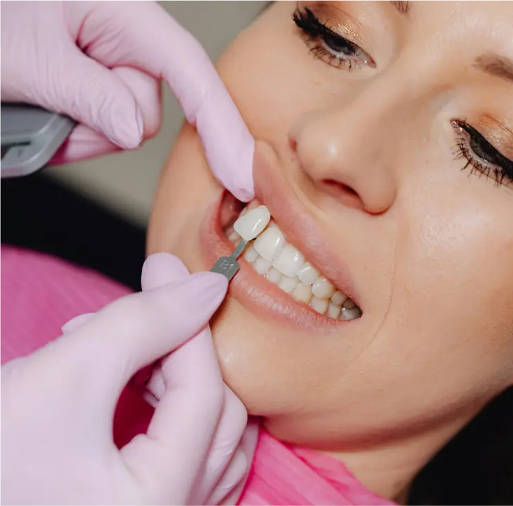 Zahnarzt in Frankfurt passt Zahnfarbe für ästhetische Zahnheilkunde an