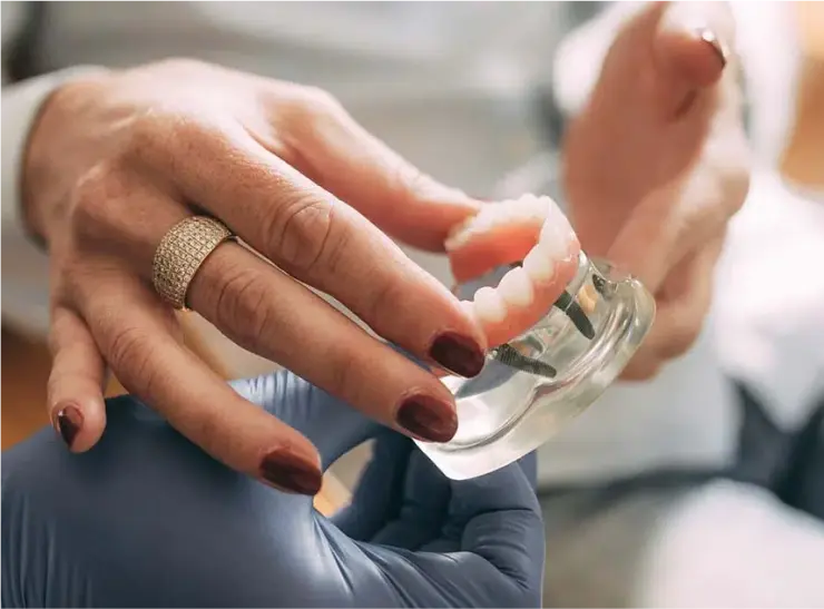 Modell einer Zahnimplantatprothese – Zahnarzt zeigt einem Patienten die Struktur und Funktion eines Zahnimplantats mit künstlichem Zahnfleisch.