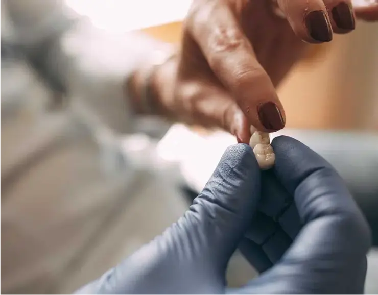 Nahaufnahme eines Zahnersatzes in der Zahnarztpraxis Sandhofpassage Frankfurt. Eine Zahnbrücke wird von einer Zahnarzthelferin und einer Patientin begutachtet.