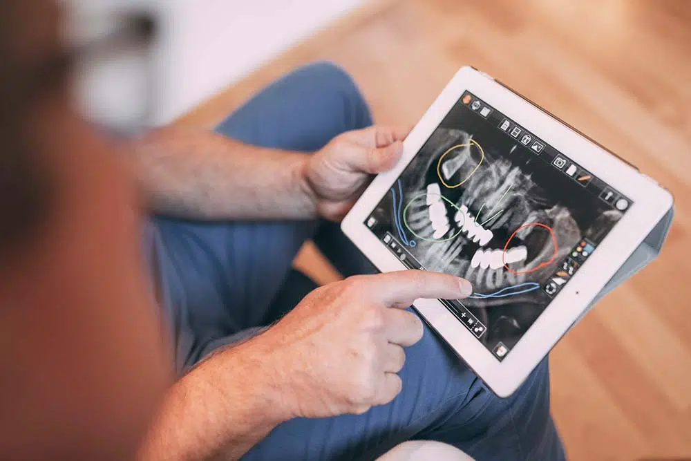 Digitale Zahnröntgenanalyse beim Zahnarzt in Sandhofpassage Frankfurt – Darstellung von Zahnbefunden zur präzisen Diagnostik